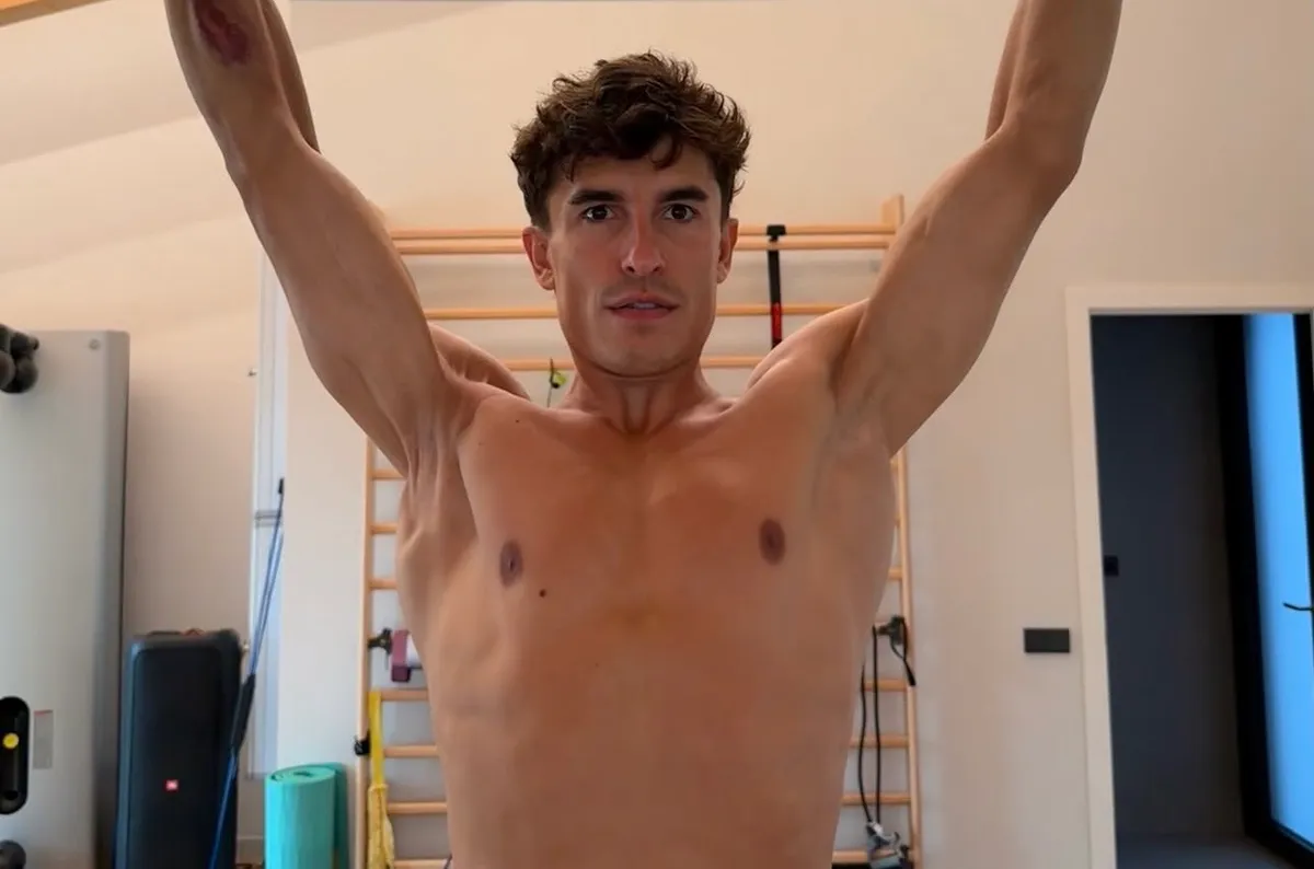 Marc Marquez's Arm Dilemma: Not Normal, Never Will Be, Doctor Reveals